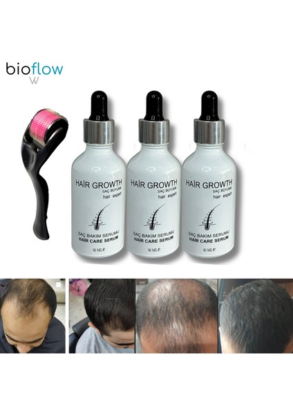 Hair Serum Saç Bakım Yağı / 3 Adet + Roller