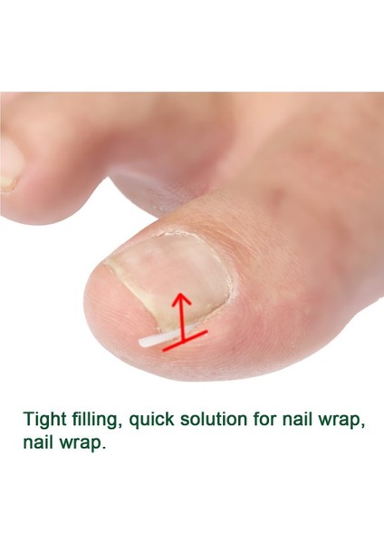 10'lu Batık Ayak Tırnağı Düzeltici Ped Ayak Bakımı (Yurt Dışından) fırsatları