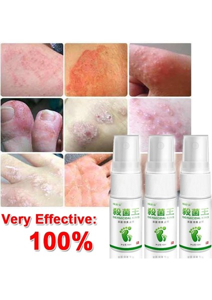 15MLX1 Kozmetik Ayak Soyma Spreyi Doğal Portakal Özü Pedikür Eller Ölü Cilt Exfoliator Maske Beyazlatmak Bebek Ayak Bakımı Aracı (Yurt Dışından)