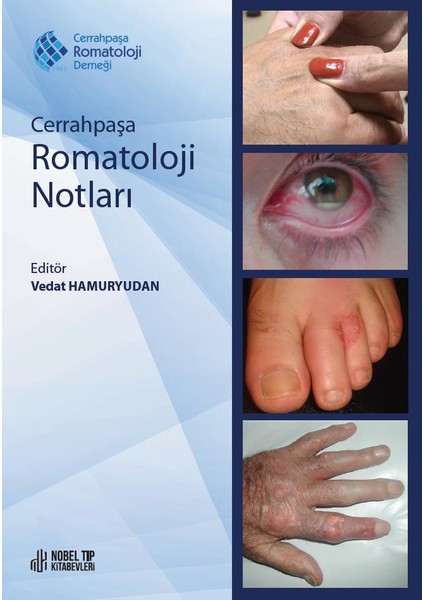 Cerrahpaşa Romatoloji Notları - Vedat Hamuryudan