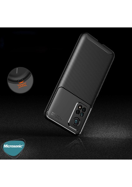 Xiaomi Mi 10T Kılıf Legion Series Kahverengi