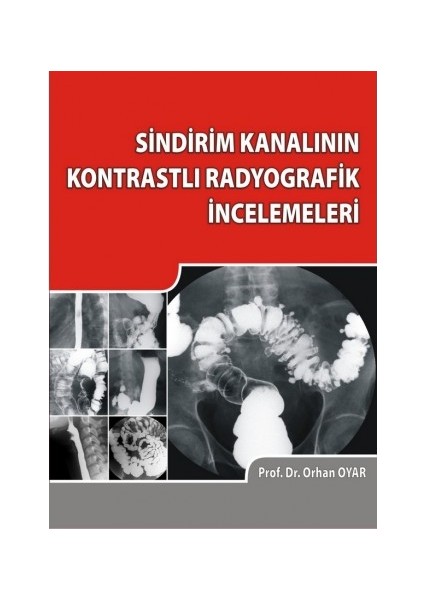 Sindirim Kanalının Kontrastlı Radyografik İncelemeleri - Orhan Oyar