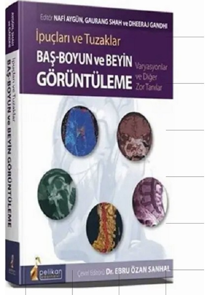İpuçları ve Tuzaklar Baş - Boyun ve Beyin Görüntüleme Varyasyonlar ve Diğer Zor Tanılar - Ebru Özan Sanhal
