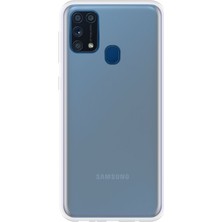 Newface Samsung Galaxy M31 Kılıf Lüx Şeffaf Silikon