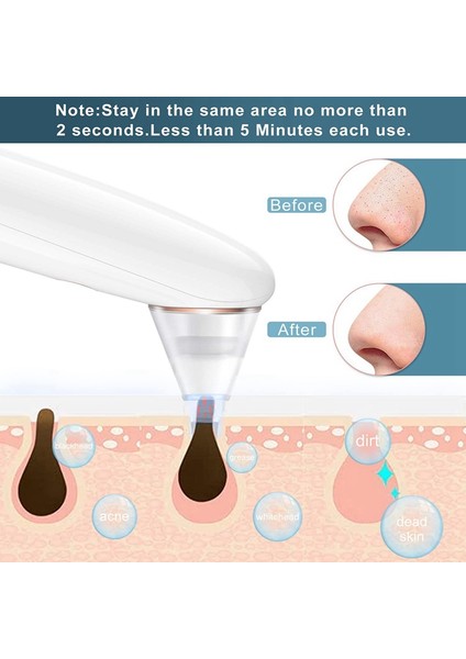Cilt Temizleyici Vakum (Yurt Dışından) fırsatları