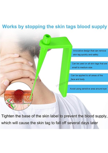Papilloma Temizleme Aracı Küçük ve Orta Yüz Bakımı Için Mavi Mikro Bant Cilt Etiketi Sökücü Kit Mısır Temizleme Çubukları ile Köstebek Siğilyeşil (2-4mm)（yeşil (2-4mm)） (Yurt Dışından)