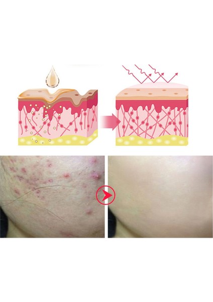 Cilt Serumu Cilt Temizleme Kremi (Yurt Dışından) fırsatları