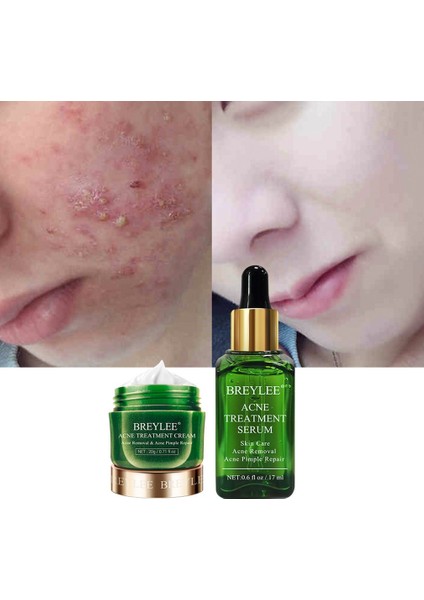 Cilt Serumu Cilt Temizleme Kremi (Yurt Dışından) indirimleri