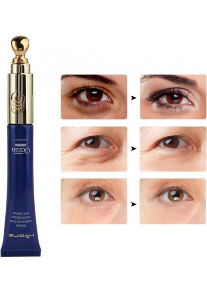 Göz Kremi Jel (Yurt Dışından)