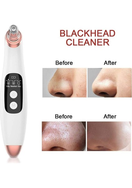 Elektrikli Cilt Temizleyici Çok Fonksiyonlu (Yurt Dışından) fiyatları