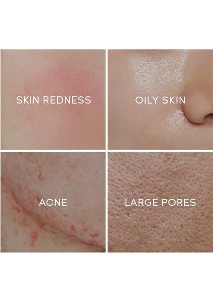 Adet Yeşil Çay Yüz Serumu Kuru Ve Yağlı Cilt Bakımı (Yurt Dışından) fiyatları