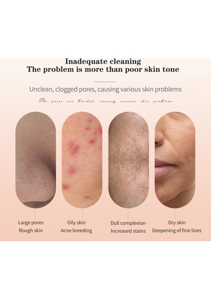 Trendygirl Cilt Temizleme Aracı Üç Vites Ayarı Elektrikli (Yurt Dışından) modelleri