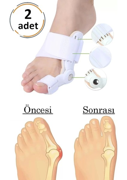 Başarı Ortopedi Ayak Parmak Başparmak Düzeltici Kemik Çıkığı Düzleştirici Taraklı Ayaklar Için Aparat 2'li