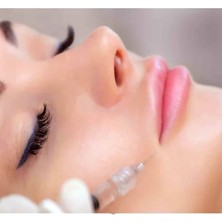 Rosevelt Hyaluronic Asid Soft Göz Altı Dolgusu 1 ml
