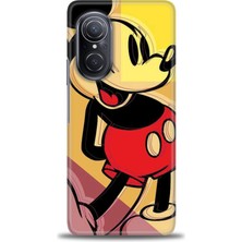 gmotp Huawei Nova 9 Se Kılıf Hd Baskılı - Mickey Mousee