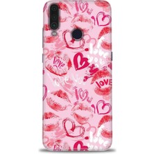 gmotp General Mobile Gm 10 Kılıf Hd Baskılı - Pembe Love