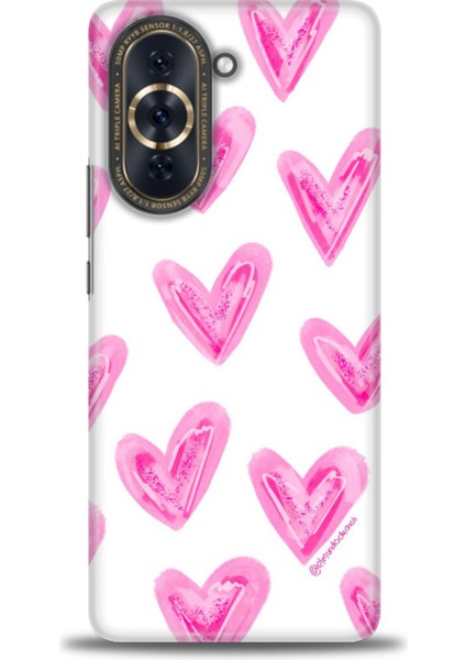 Huawei Nova 10 Pro Kılıf Hd Baskılı - Pembe Kalpler