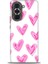 Huawei Nova 10 Pro Kılıf Hd Baskılı - Pembe Kalpler 1