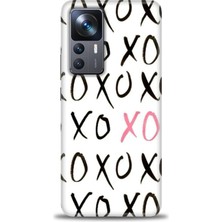 gmotp Xiaomi Mi 12T Pro Kılıf Hd Baskılı Kılıf - Xoxo