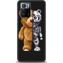 gmotp Xiaomi Poco X3 Gt Kılıf Hd Baskılı Kılıf - Ayı ve Iskeleti