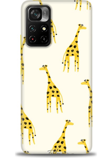 Xiaomi Redmi Note 11 Pro Plus Kılıf Hd Baskılı Kılıf - Zürafa