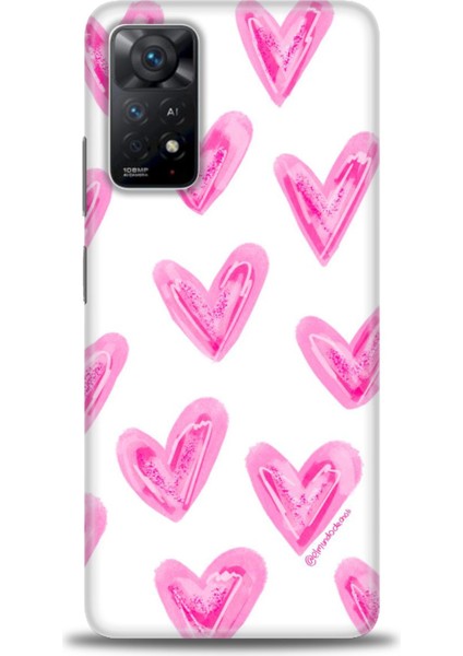 Xiaomi Redmi Note 11 Pro Kılıf Hd Baskılı Kılıf - Pembe Kalpler