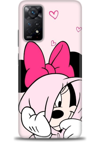 Xiaomi Redmi Note 11 Pro Kılıf Hd Baskılı Kılıf - Pink