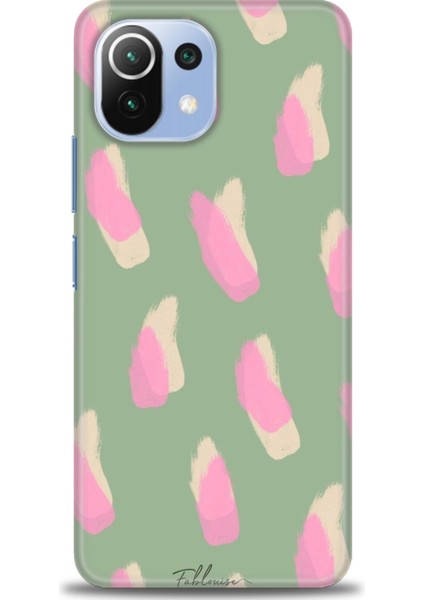 Xiaomi Mi 11 Lite Kılıf Hd Baskılı Kılıf - Pembe Krem