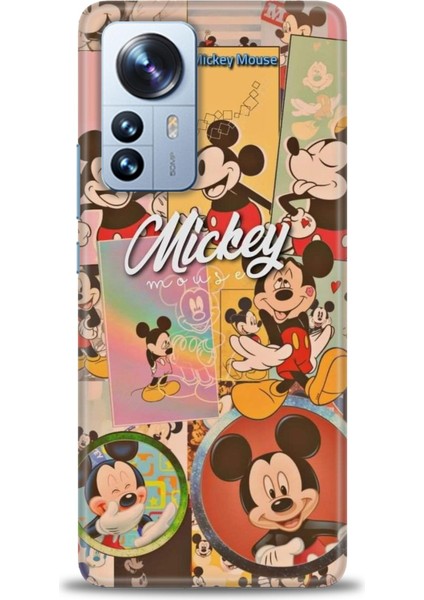Xiaomi Mi 12 Pro Kılıf Hd Baskılı Kılıf - I Love Mickey