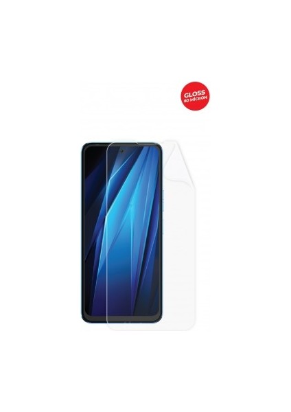 Tecno Pova Neo 2 Ekran Koruyucu Tpu Film