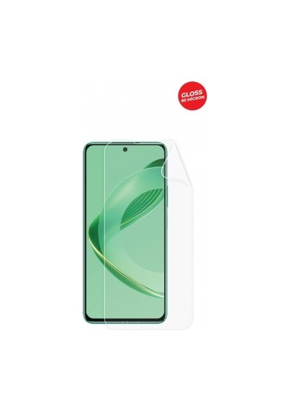 Huawei Nova 11 Se Ekran Koruyucu Tpu Film