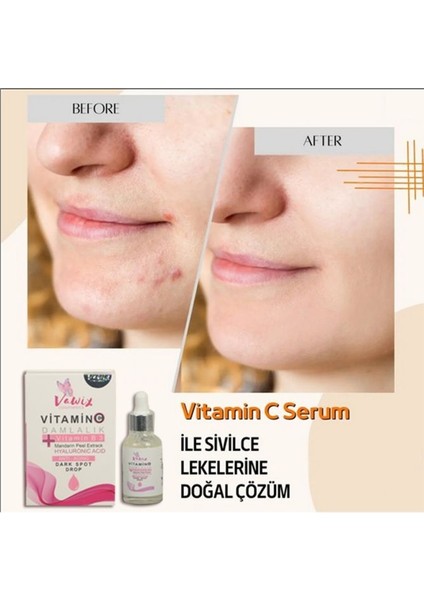 Vitamin C Serum