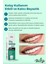 Illa Life Whitening Expert Hızlı Etkili Diş Jel Yeni Nesil Diş Beyazlatma Ve Temizleme Jeli 50 Ml 4