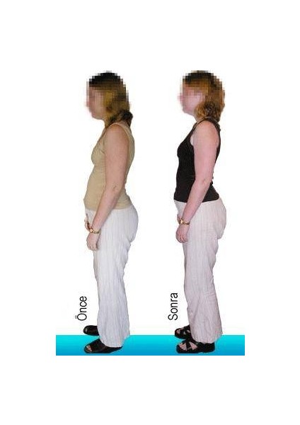 Backtone Duruş Düzeltici Small Beden fiyatları