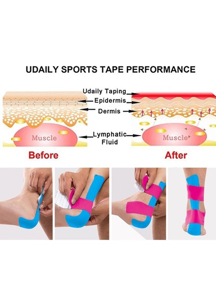 Kırmızı 1 Adet Tarzı Lld 5CMX5M Kinesiyoloji Bandı Nefes Alabilir Yastık Yapıştırıcı Alçı Yara Hemostaz Etiket Bandı Ilk Yardım Bandajı (Yurt Dışından) fırsatları