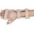 Statik El Bilek Splinti (W 335) Sağ-Large 1