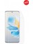 Honor 100 Ekran Koruyucu Tpu Film 1
