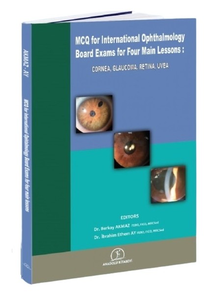 Mcq For Internatıonal Board Exams In Four Maın Lessons: Cornea, Glaucoma, Retına, Uvea - Berkay Akmaz