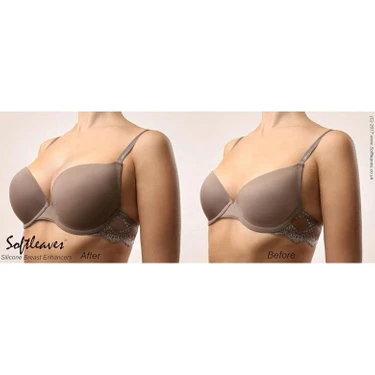 Softleaves Classic X100 Silicone Breast Enhancers