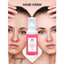 ASİMEYZ Sivilce Önleyici ve Sivilce Karşıtı Akne Siyah Nokta Giderici Nemlendirici Krem Anti-Acne 150 ml