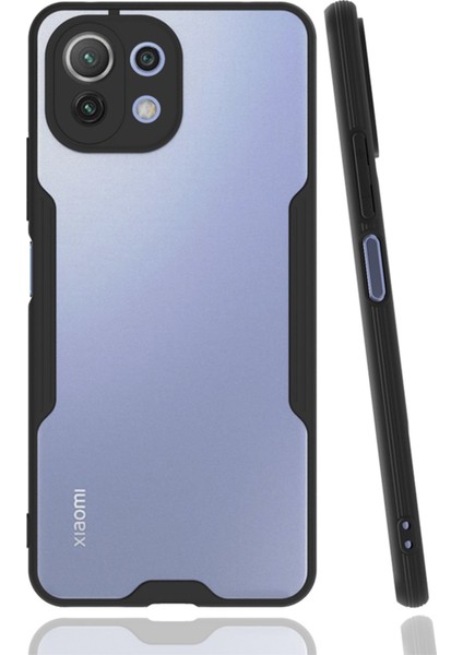 Xiaomi Mi 11 Lite Kılıf Platin Silikon - Siyah 300099