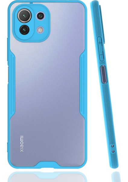 Xiaomi Mi 11 Lite Kılıf Platin Silikon - Mavi 300099