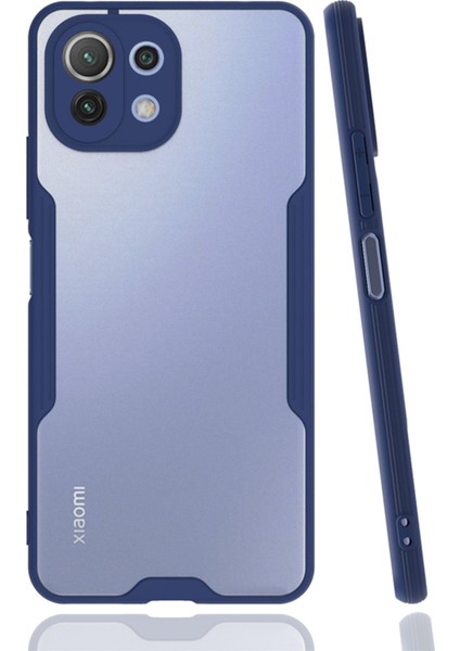 Xiaomi Mi 11 Lite Kılıf Platin Silikon - Lacivert 300099