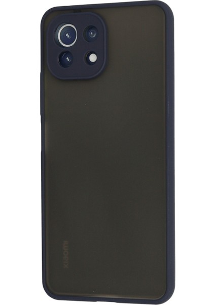 Xiaomi Mi 11 Lite Kılıf Montreal Silikon Kapak - Lacivert 300099