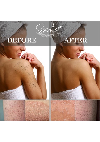Serentia Banyo Duş Kesesi Peeling Eldiveni Floş Ipek %100 Bay ve Bayanlar Için indirimleri