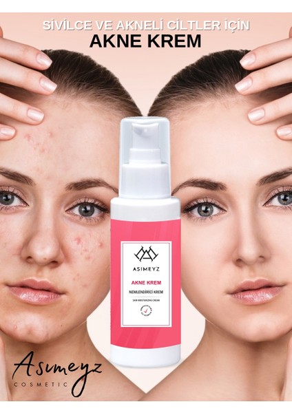 Sivilce Önleyici ve Sivilce Karşıtı Akne Siyah Nokta Giderici Nemlendirici Krem Anti-Acne 150 ml