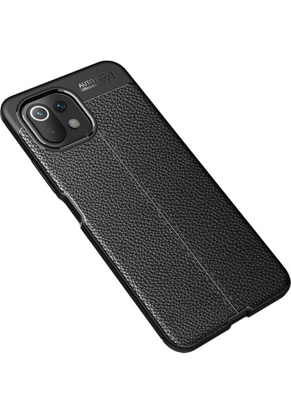 Xiaomi Mi 11 Lite Kılıf Focus Derili Silikon - Siyah 300099