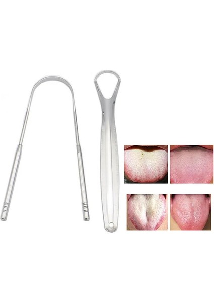 Küçük Stil Yetişkinler Için Dil Kazıyıcı Temizleyici Cerrahi Sınıf Paslanmaz Çelik Metal Dil Fırçası Diş Kiti Profesyonel Kötü Nefesi Ortadan Kaldırır (Yurt Dışından)