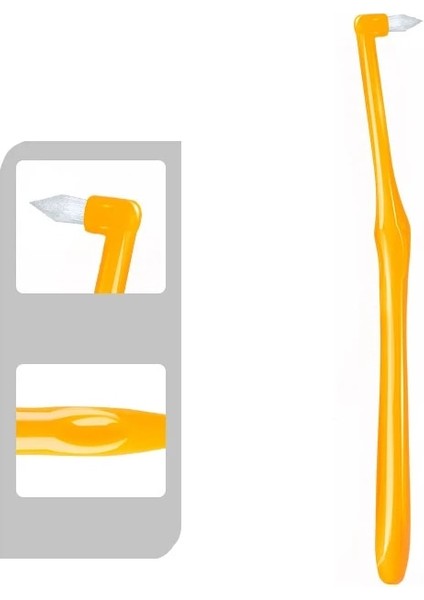 Sivri Kafa Sarı Tarzı 1 Adet Ortodontik Diş Fırçası Interdental Diş Fırçası Küçük Kafa Yumuşak Saç Düzeltme Diş Parantez Diş Ipi Ağız Diş Bakımı (Yurt Dışından)