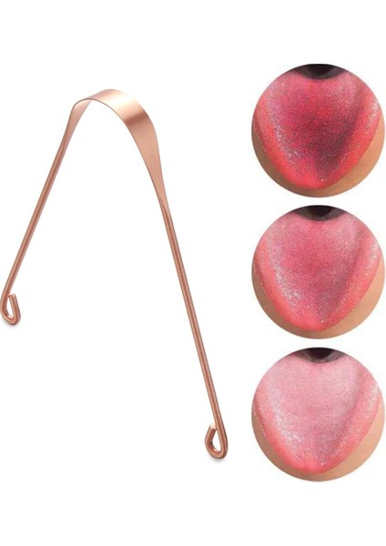 C-Mavi Tarzı 1 Adet Dil Kazıyıcı Temizleyici Metalsilikon Temizleme Kazıyıcı Dil Diş Fırçası Diş Ağız Kokusu Bakımı Taze Nefes Ağız Bakımı Aracı (Yurt Dışından)